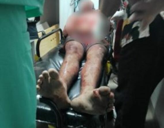 Homem agredido com machado em Tocos 270x360 1