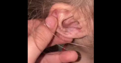 Menina de 3 anos violentamente agredida recebe alta de hospital e se recupera; polícia procura pelo suspeito