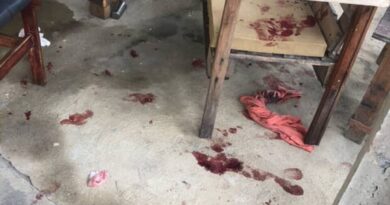 Bebê é atacado por pitbull na Baixada Campista e está em estado grave