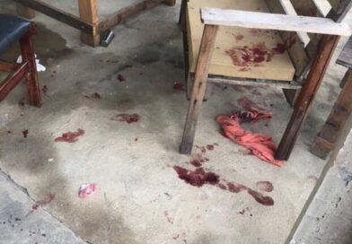 Bebê é atacado por pitbull na Baixada Campista e está em estado grave