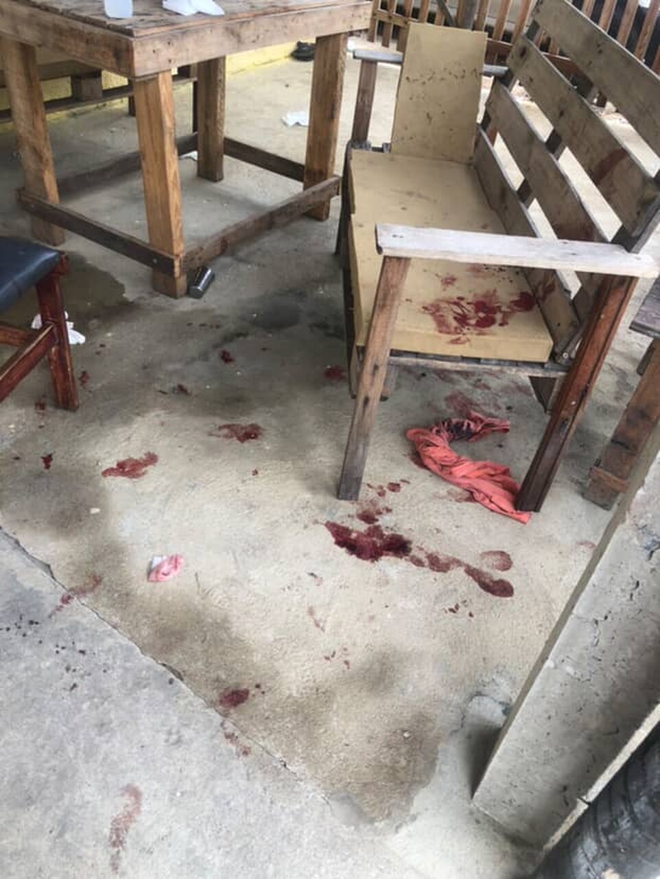 Bebê é atacado por pitbull na Baixada Campista e está em estado grave