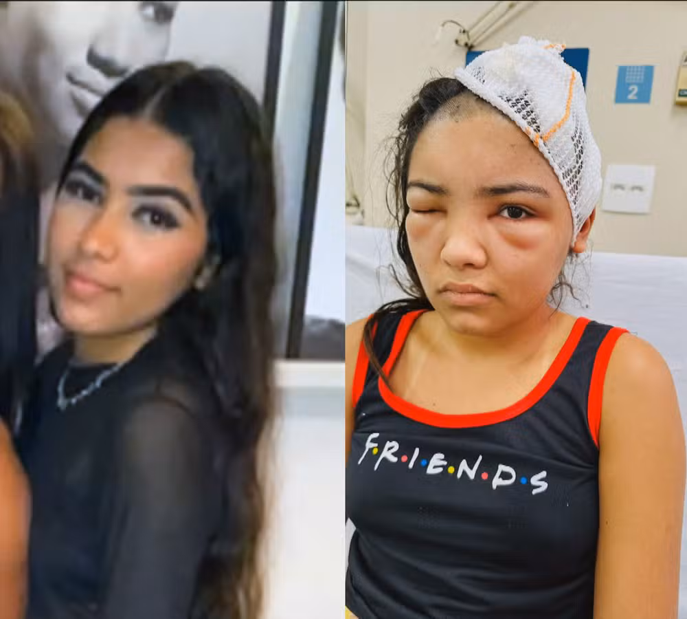 Jovem é baleada na cabeça durante encontro; vítima perdeu a memória, diz família 1 09maria copiar